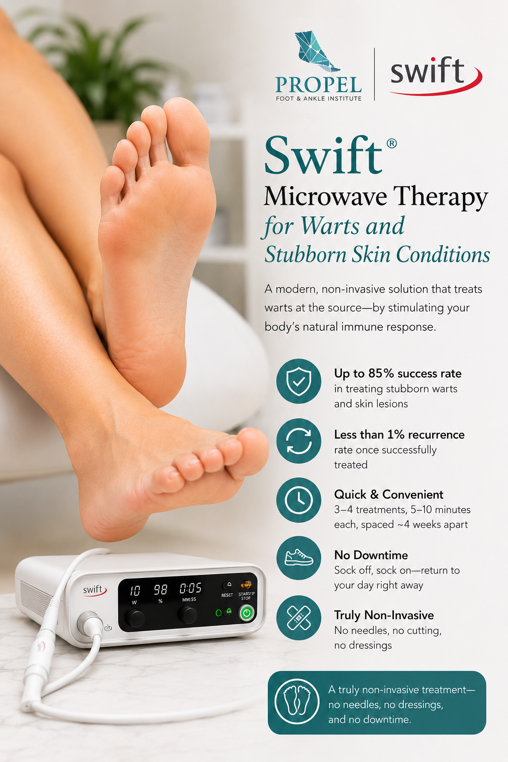 Swift® Microwave Therapy for Warts and Stubborn Skin Conditions